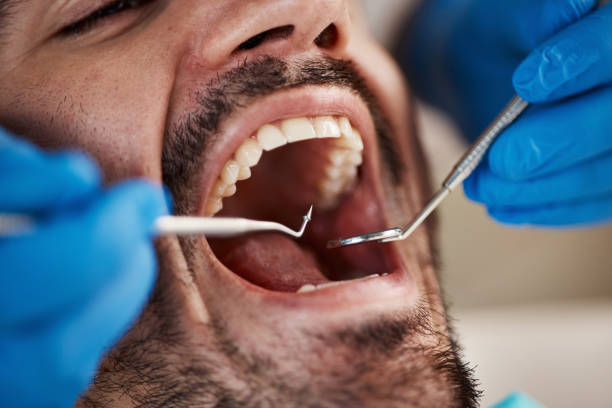 Best Emergency Tooth Extraction in Pawnee, OK